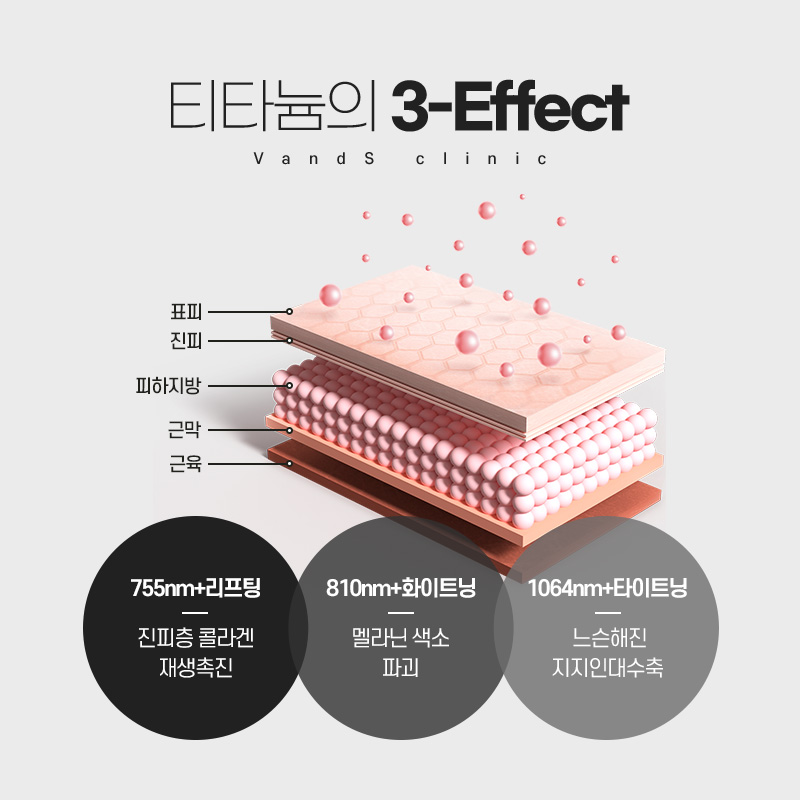 티타늄 시술안내 이미지2