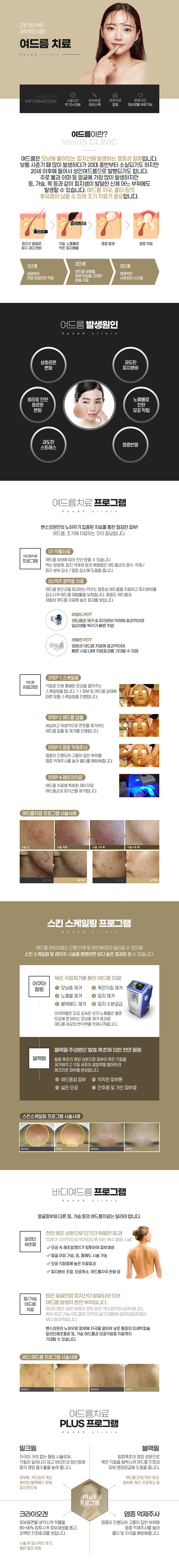    	 여드름 치료 시술안내 이미지1