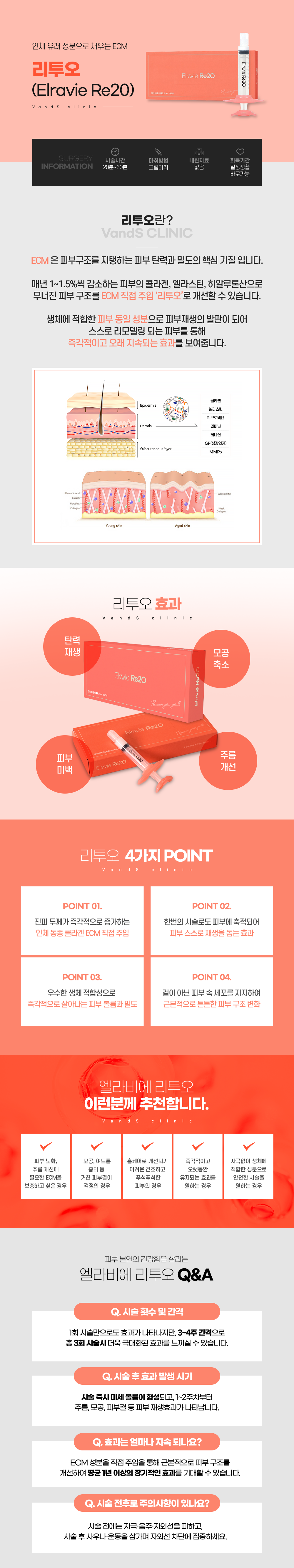 엘라비에 리투오 시술안내 이미지1